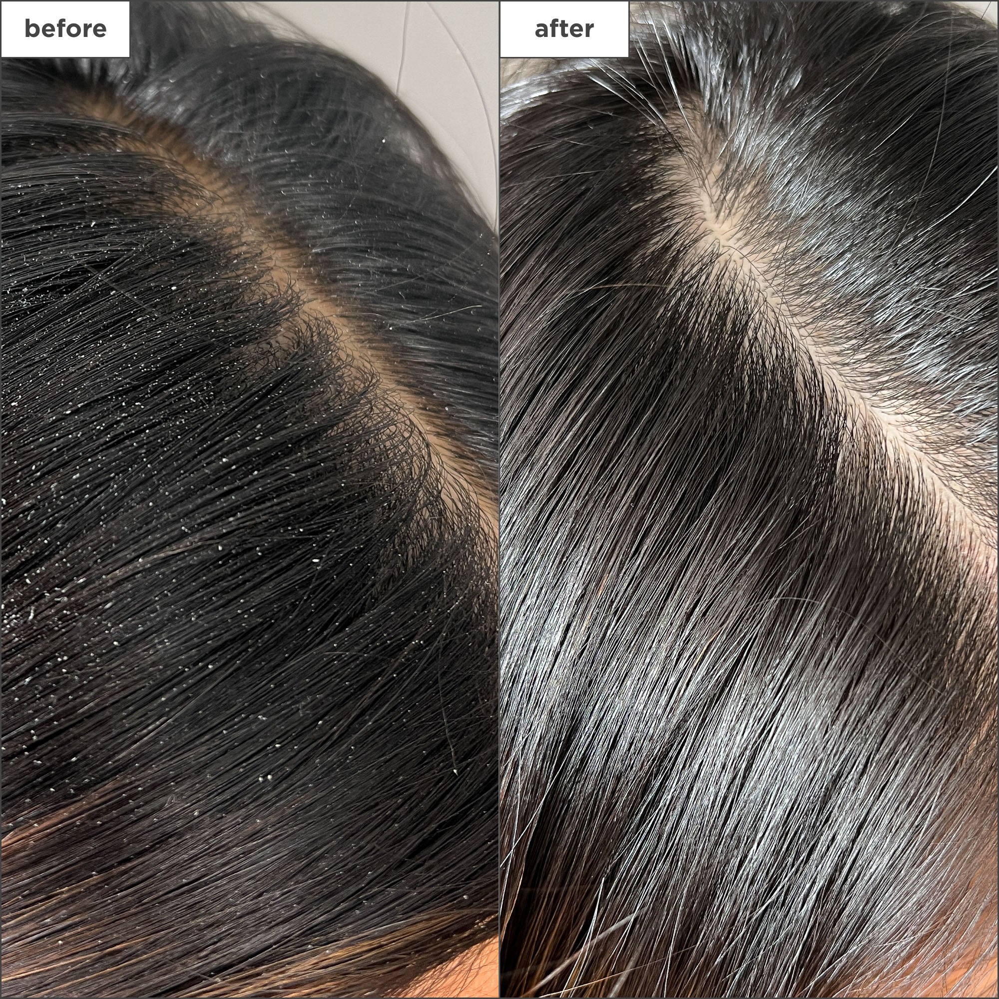 Scalp Revival Charcoal + Tea Tree Buildup Detox Spray - Briogeo